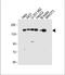 ATP-dependent DNA helicase Q4 antibody, A03130-1, Boster Biological Technology, Western Blot image 