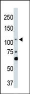 Large Tumor Suppressor Kinase 2 antibody, 62-609, ProSci, Western Blot image 