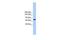 Transmembrane Channel Like 2 antibody, GTX45881, GeneTex, Western Blot image 