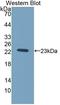 TIMP Metallopeptidase Inhibitor 1 antibody, LS-C738764, Lifespan Biosciences, Western Blot image 