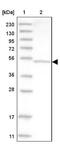 Aspartyl Aminopeptidase antibody, NBP1-91684, Novus Biologicals, Western Blot image 