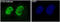 ATM Serine/Threonine Kinase antibody, M00014, Boster Biological Technology, Western Blot image 