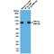 His tag antibody, GTX33607, GeneTex, Immunoprecipitation image 