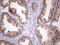 Charged Multivesicular Body Protein 5 antibody, M07734, Boster Biological Technology, Immunohistochemistry paraffin image 