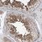 SOGA Family Member 3 antibody, HPA035389, Atlas Antibodies, Immunohistochemistry paraffin image 