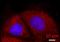 Spectrin Alpha, Non-Erythrocytic 1 antibody, NBP1-53093, Novus Biologicals, Immunocytochemistry image 
