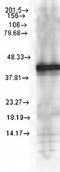 Calcium/Calmodulin Dependent Protein Kinase II Beta antibody, orb67325, Biorbyt, Western Blot image 