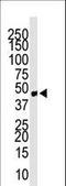 Atypical Chemokine Receptor 2 antibody, LS-C97667, Lifespan Biosciences, Western Blot image 