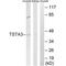 Tissue Specific Transplantation Antigen P35B antibody, PA5-50038, Invitrogen Antibodies, Western Blot image 