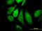 Component Of Inhibitor Of Nuclear Factor Kappa B Kinase Complex antibody, LS-C133120, Lifespan Biosciences, Immunofluorescence image 