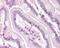 Regulator Of Telomere Elongation Helicase 1 antibody, 49-797, ProSci, Immunohistochemistry paraffin image 