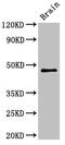 Transmembrane protein 49 antibody, LS-C679989, Lifespan Biosciences, Western Blot image 