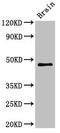 Vacuole Membrane Protein 1 antibody, LS-C679989, Lifespan Biosciences, Western Blot image 