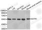 Somatostatin Receptor 1 antibody, A3332, ABclonal Technology, Western Blot image 