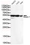 Keratin 7 antibody, STJ99060, St John
