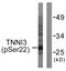 Troponin I3, Cardiac Type antibody, LS-C199667, Lifespan Biosciences, Western Blot image 