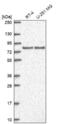 Discs Large MAGUK Scaffold Protein 3 antibody, NBP2-58864, Novus Biologicals, Western Blot image 