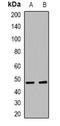 Neutrophil Cytosolic Factor 1 antibody, orb382455, Biorbyt, Western Blot image 