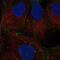 Desmoglein 2 antibody, NBP1-85709, Novus Biologicals, Immunocytochemistry image 