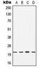Cell Division Cycle 42 antibody, MBS822198, MyBioSource, Western Blot image 