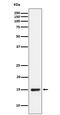 NADH:Ubiquinone Oxidoreductase Subunit B4 antibody, M11016, Boster Biological Technology, Western Blot image 