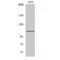 Catenin Delta 1 antibody, LS-C385261, Lifespan Biosciences, Western Blot image 