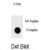 Inhibitor Of Nuclear Factor Kappa B Kinase Subunit Beta antibody, abx032159, Abbexa, Dot Blot image 