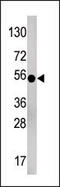 Protein Phosphatase, Mg2+/Mn2+ Dependent 1A antibody, LS-C101066, Lifespan Biosciences, Western Blot image 