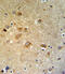 GTSE1 antibody, 64-164, ProSci, Immunohistochemistry paraffin image 