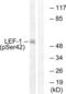 Lymphoid Enhancer Binding Factor 1 antibody, LS-C199196, Lifespan Biosciences, Western Blot image 