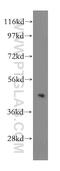 Tribbles Pseudokinase 2 antibody, 15359-1-AP, Proteintech Group, Western Blot image 