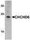 Coiled-Coil-Helix-Coiled-Coil-Helix Domain Containing 6 antibody, A09965, Boster Biological Technology, Western Blot image 