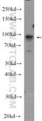 Leucine Zipper Tumor Suppressor 2 antibody, 15677-1-AP, Proteintech Group, Western Blot image 