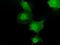 Transketolase antibody, GTX83510, GeneTex, Immunocytochemistry image 