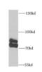 Aryl Hydrocarbon Receptor Nuclear Translocator 2 antibody, FNab00595, FineTest, Western Blot image 