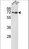 Kruppel Like Factor 4 antibody, LS-C98588, Lifespan Biosciences, Western Blot image 