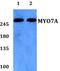 MYO7A antibody, PA5-37182, Invitrogen Antibodies, Western Blot image 