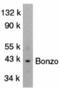 C-X-C Motif Chemokine Receptor 6 antibody, 2415, QED Bioscience, Western Blot image 