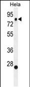 Slingshot Protein Phosphatase 3 antibody, PA5-35067, Invitrogen Antibodies, Western Blot image 