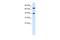 TOX High Mobility Group Box Family Member 2 antibody, A12956, Boster Biological Technology, Western Blot image 