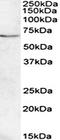 Carnitine O-Octanoyltransferase antibody, orb107646, Biorbyt, Western Blot image 