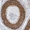 CDK5 Regulatory Subunit Associated Protein 3 antibody, PA5-54569, Invitrogen Antibodies, Immunohistochemistry paraffin image 