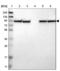 Protein Phosphatase 2 Scaffold Subunit Abeta antibody, NBP1-87251, Novus Biologicals, Western Blot image 