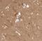 BAALC Binder Of MAP3K1 And KLF4 antibody, NBP1-89443, Novus Biologicals, Immunohistochemistry paraffin image 