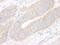 Protein CIP2A antibody, A301-453A, Bethyl Labs, Immunohistochemistry paraffin image 