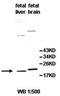Interleukin 20 Receptor Subunit Beta antibody, orb77884, Biorbyt, Western Blot image 