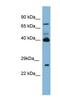 Transglutaminase 3 antibody, NBP1-57678, Novus Biologicals, Western Blot image 