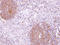 Mitogen-Activated Protein Kinase Kinase Kinase Kinase 5 antibody, LS-C186062, Lifespan Biosciences, Immunohistochemistry frozen image 