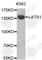 Large Tumor Suppressor Kinase 1 antibody, A7159, ABclonal Technology, Western Blot image 