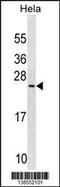 PRELI Domain Containing 1 antibody, 59-879, ProSci, Western Blot image 